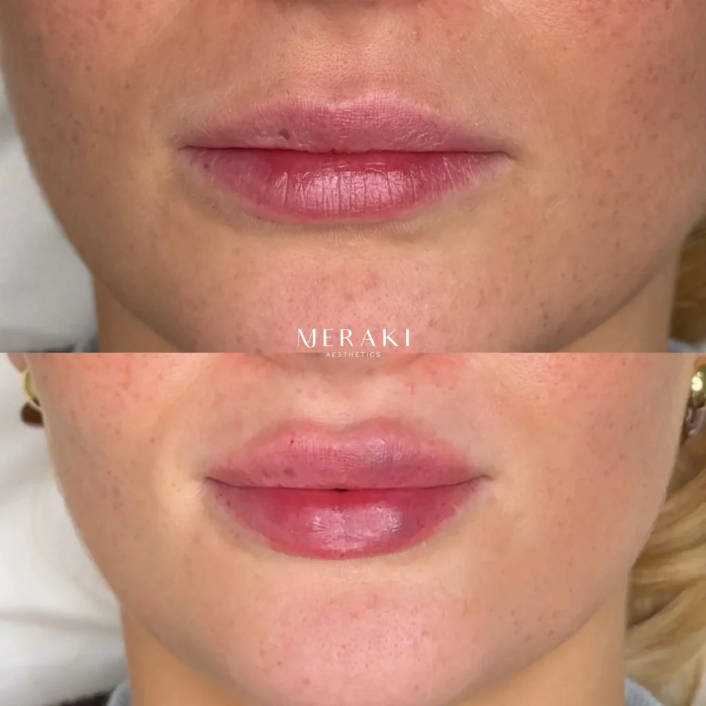 lip