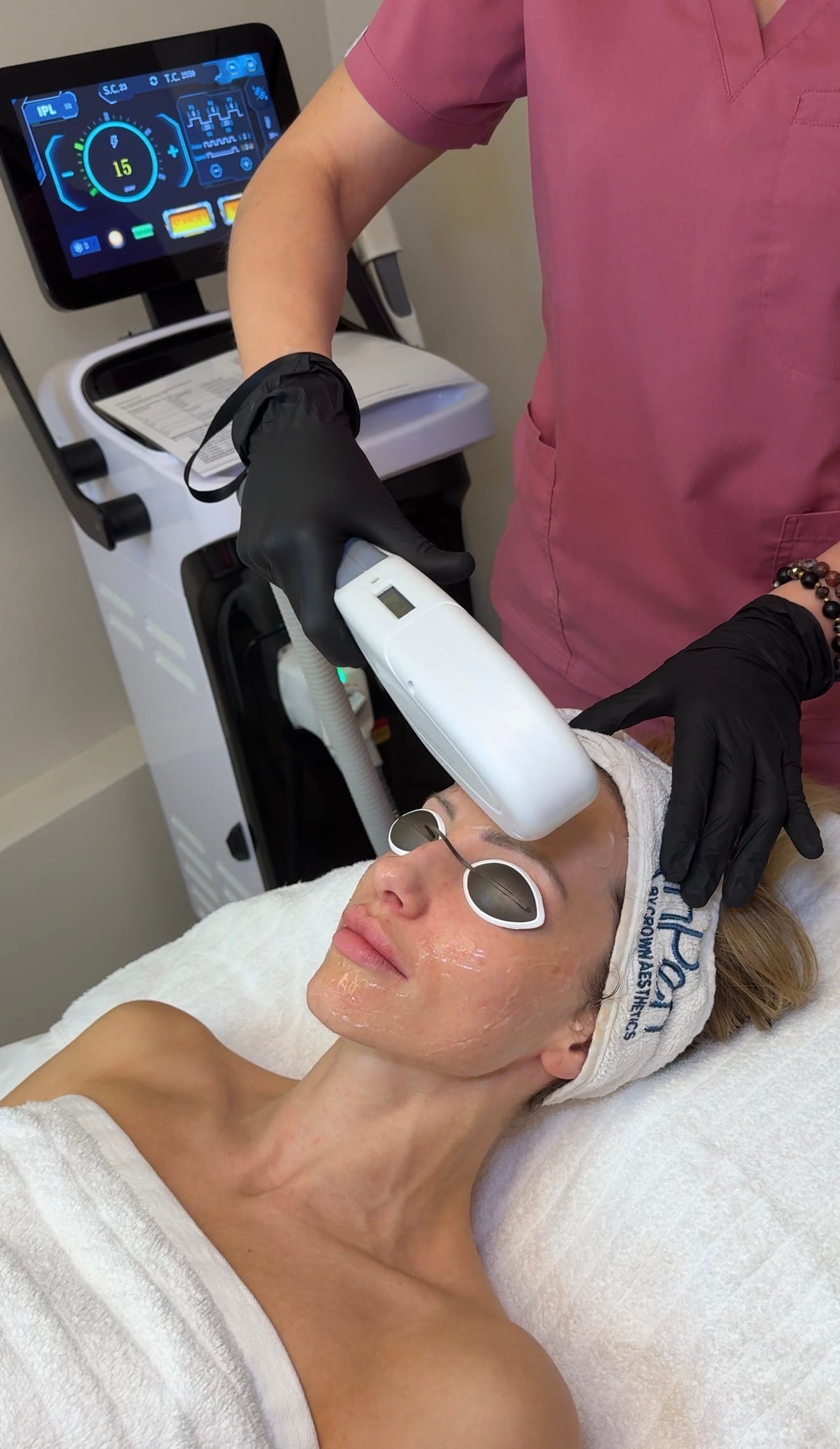 IPL laser treatment being performed at Meraki Aesthetics clinic