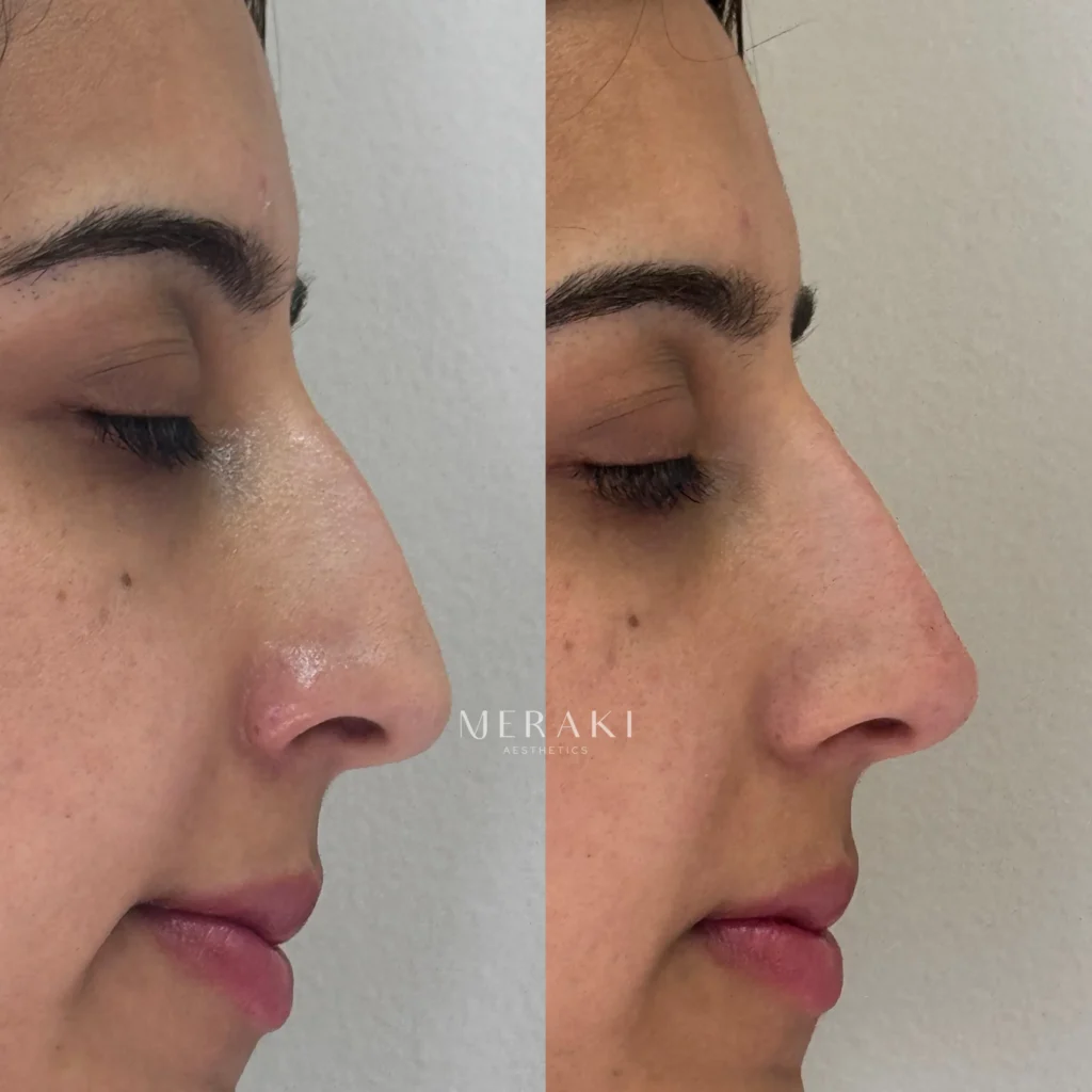 Profile Harmonization